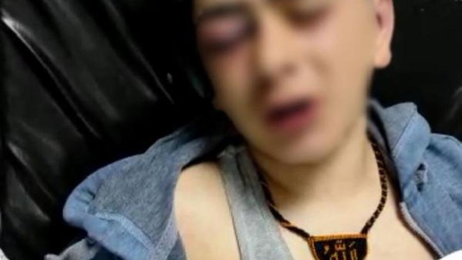 Çocuğa işkenceden tutuklanan 2 polis serbest